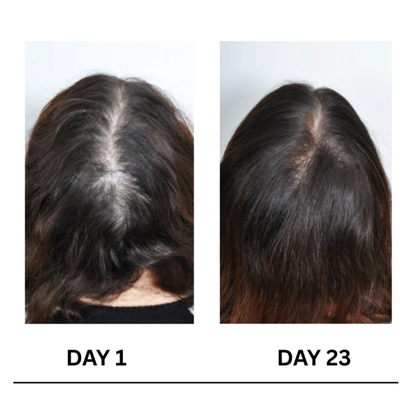 Scalpy Boost+ Hair Growth
